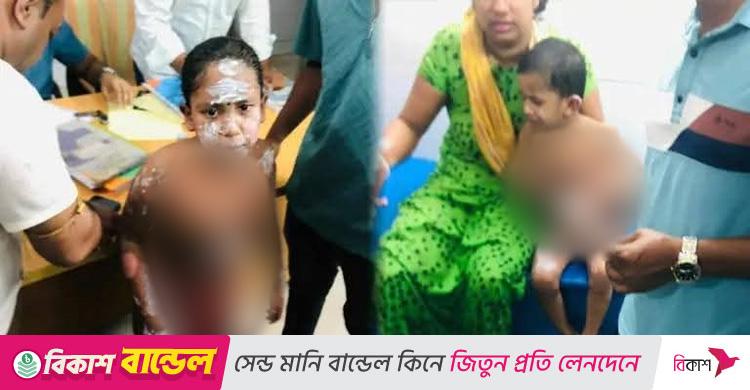 নোয়াখালীতে গ্যাস বিস্ফোরণ, এক পরিবারের ৪ জন দগ্ধ