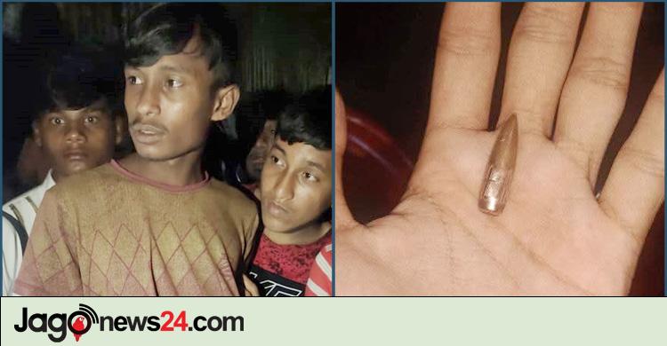 টেকনাফ / সীমান্তের ওপারে গোলাগুলি, এপারে গুলিবিদ্ধ রোহিঙ্গা যুবক