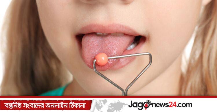 আন্তর্জাতিক তোতলামি সচেতনতা দিবস / তোতলামি কোনো রোগ নয়, সহজেই ভালো হয়